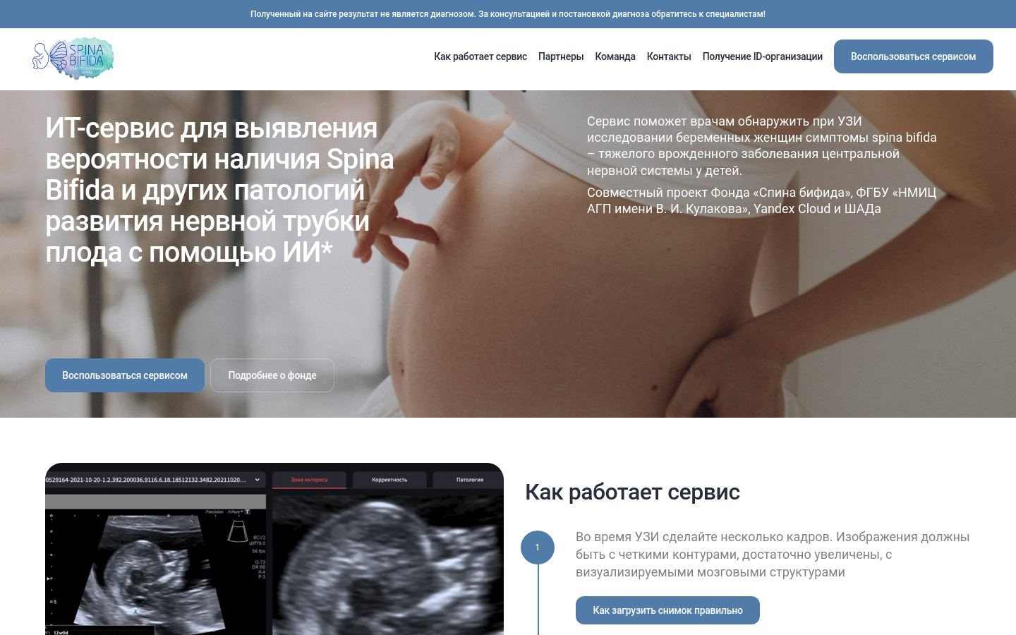 Снимок главной страницы spinabifidabackup.ru